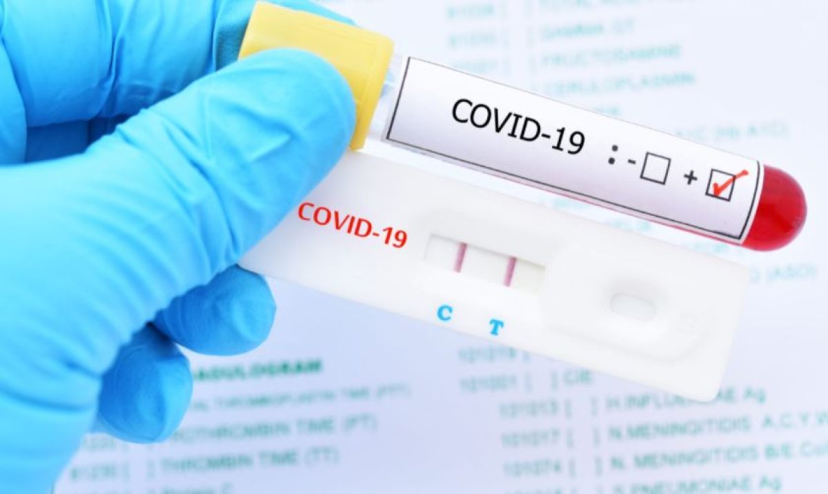 5 χρόνια Covid19: Ο κορονοϊός που άλλαξε τον πλανήτη